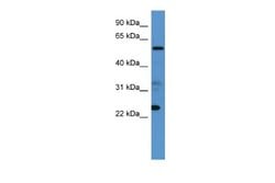 CPNE9 Rabbit anti-Human, Polyclonal, Novus Biologicals 0.1ml; Unconjugated:Antibodies,